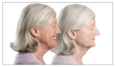 Dental Implant