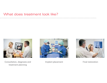 dental-implants